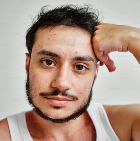 <em>Juan, 29 años</em>